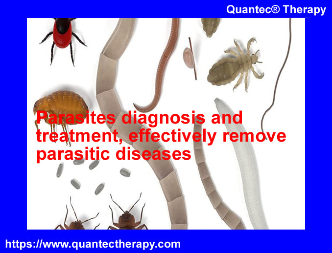 Parasites diagnosis and treatment, effectively remove parasitic diseases |  Quantec® Therapy and Energy Field Healing UK